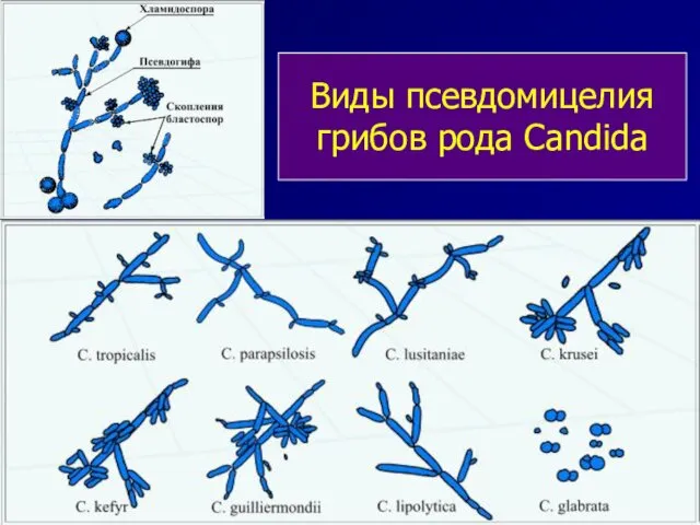 Виды псевдомицелия грибов рода Candida