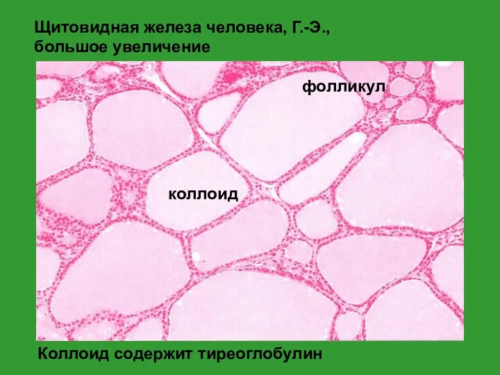 Коллоид содержит тиреоглобулин коллоид фолликул Щитовидная железа человека, Г.-Э., большое увеличение
