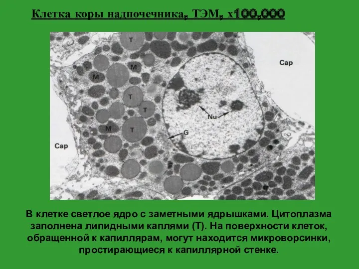 В клетке светлое ядро с заметными ядрышками. Цитоплазма заполнена липидными каплями (Т). На