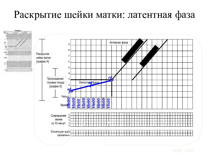 Раскрытие шейки матки: латентная фаза 09:00 10:00 11:00 12:00 13:00