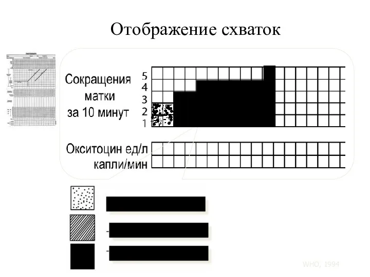 Отображение схваток Менее 20 секунд 20 - 40 секунд Более 40 секунд WHO, 1994