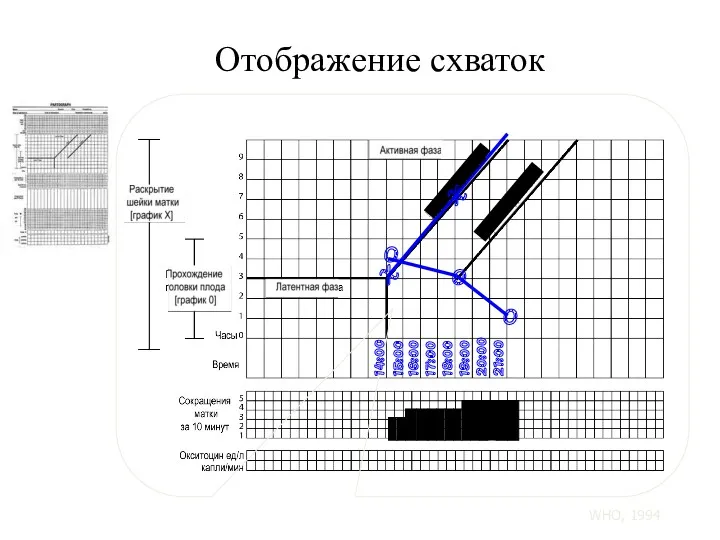 Отображение схваток 14:00 15:00 16:00 17:00 18:00 19:00 20:00 21:00