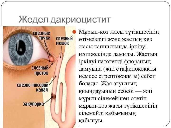 Жедел дакриоцистит Мұрын-көз жасы түтікшесінің өтімсіздігі және жастың көз жасы