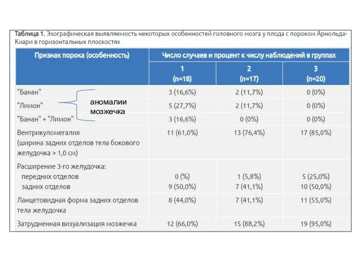 аномалии мозжечка