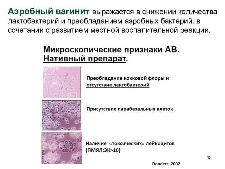 Аэробный вагинит выражается в снижении количества лактобактерий и преобладанием аэробных