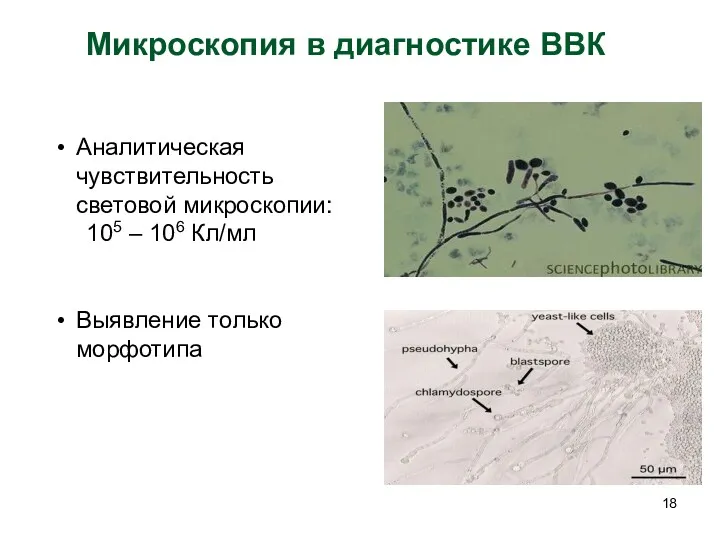 Микроскопия в диагностике ВВК Аналитическая чувствительность световой микроскопии: 105 – 106 Кл/мл Выявление только морфотипа