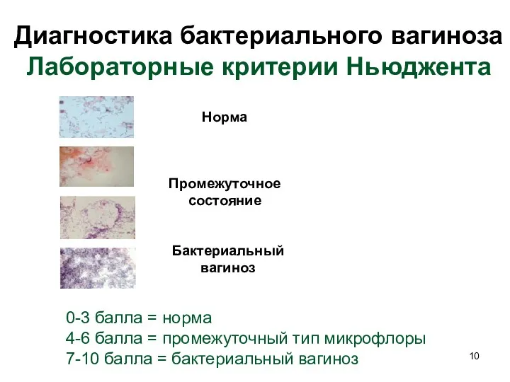 Диагностика бактериального вагиноза Лабораторные критерии Ньюджента Норма Промежуточное состояние Бактериальный
