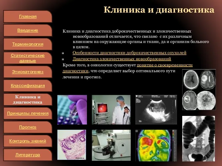 Клиника и диагностика Клиника и диагностика доброкачественных и злокачественных новообразований