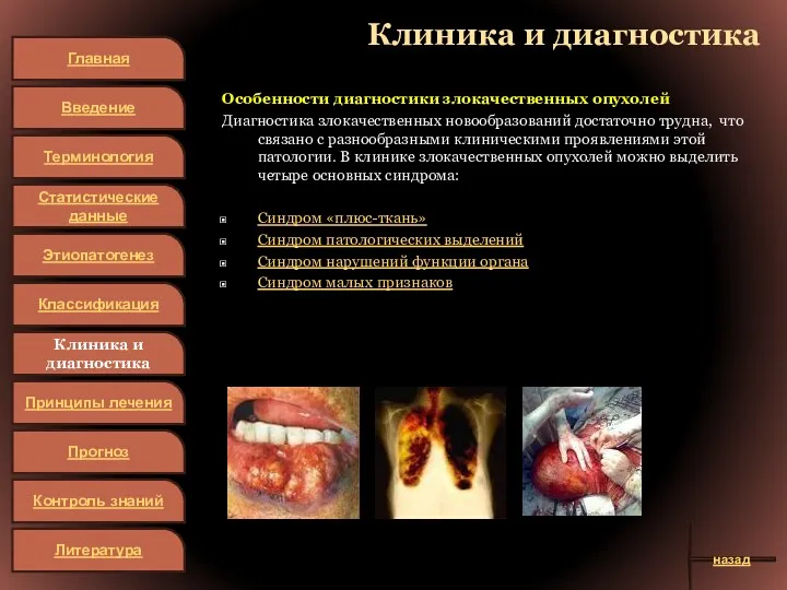 Клиника и диагностика Особенности диагностики злокачественных опухолей Диагностика злокачественных новообразований