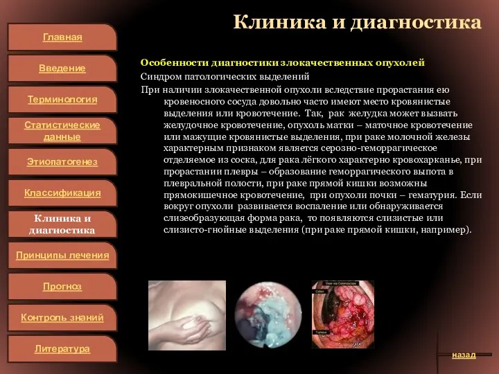 Клиника и диагностика Особенности диагностики злокачественных опухолей Синдром патологических выделений