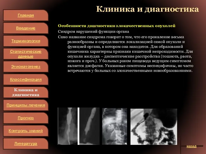 Клиника и диагностика Особенности диагностики злокачественных опухолей Синдром нарушений функции