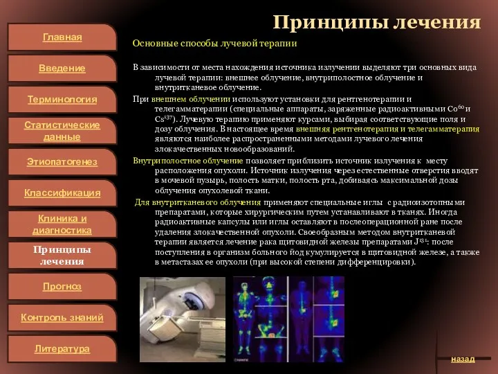 Принципы лечения Основные способы лучевой терапии В зависимости от места