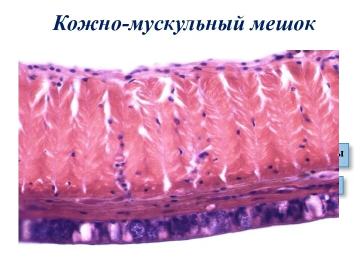 Кожно-мускульный мешок