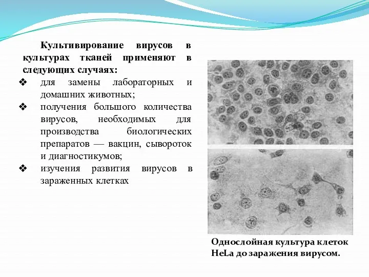 Культивирование вирусов в культурах тканей применяют в следующих случаях: для