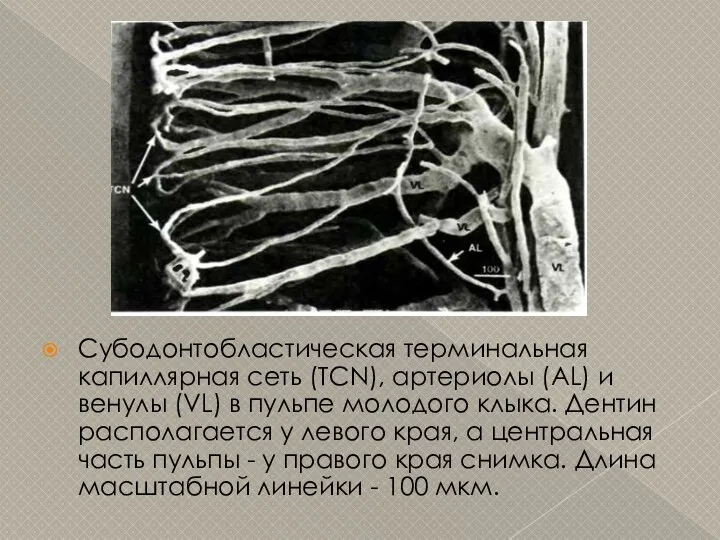 Субодонтобластическая терминальная капиллярная сеть (TCN), артериолы (AL) и венулы (VL) в пульпе молодого