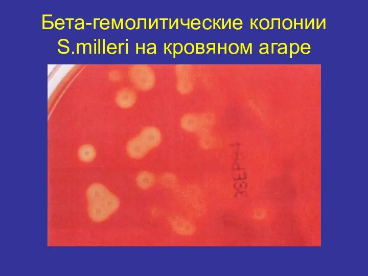 Бета-гемолитические колонии S.milleri на кровяном агаре