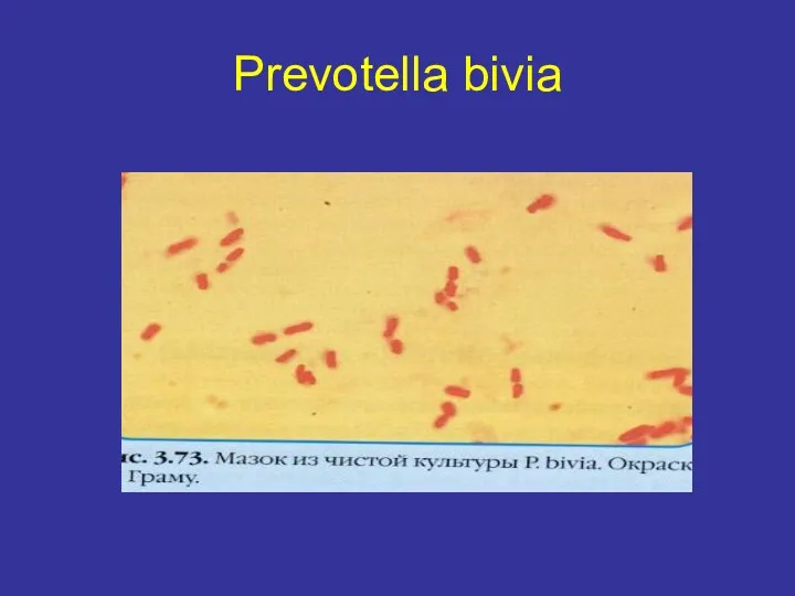 Prevotella bivia