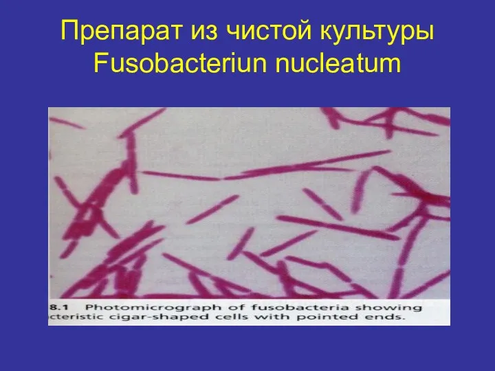 Препарат из чистой культуры Fusobacteriun nucleatum
