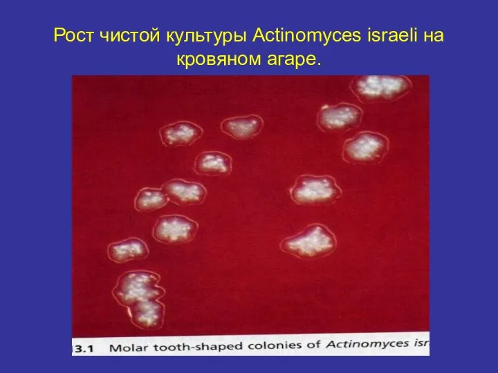 Рост чистой культуры Actinomyces israeli на кровяном агаре.