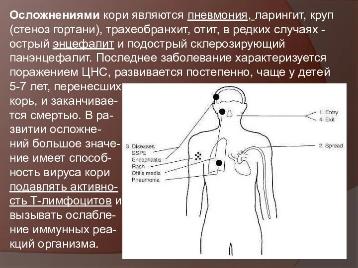 Осложнениями кори являются пневмония, ларингит, круп (стеноз гортани), трахеобранхит, отит,