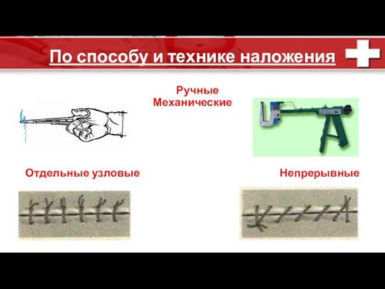 По способу и технике наложения Руч­ные Механические Отдельные узловые Непрерывные