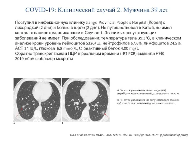 COVID-19: Клинический случай 2. Мужчина 39 лет Поступил в инфекционную клинику Jiangxi Provincial