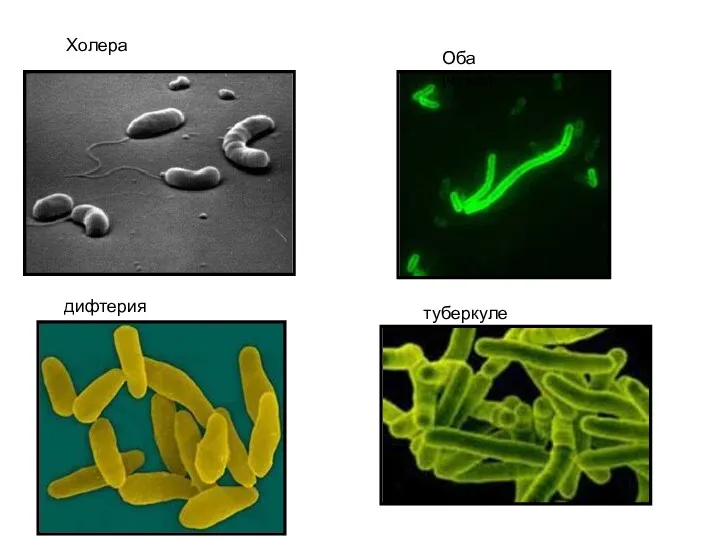 Холера Оба(чума) дифтерия туберкулез