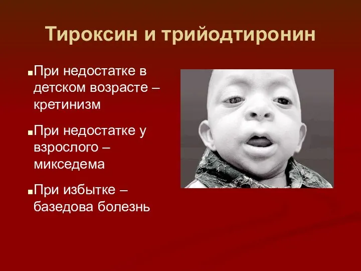 Тироксин и трийодтиронин При недостатке в детском возрасте – кретинизм При недостатке у