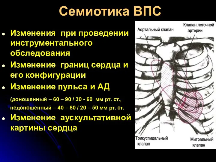 Семиотика ВПС Изменения при проведении инструментального обследования Изменение границ сердца