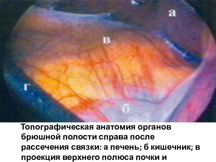 Топографическая анатомия органов брюшной полости справа после рассечения связки: а