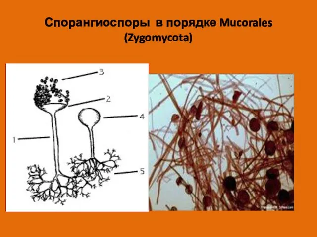 Спорангиоспоры в порядке Mucorales (Zygomycota)