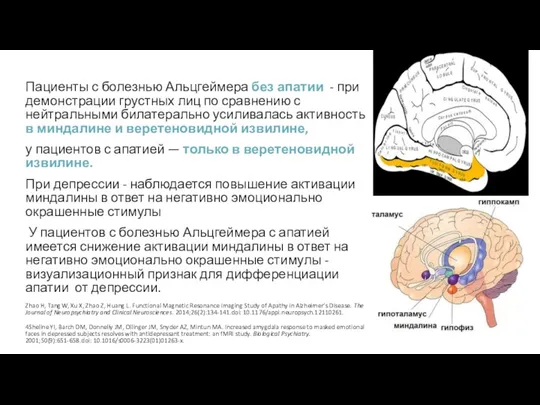 Пациенты с болезнью Альцгеймера без апатии - при демонстрации грустных