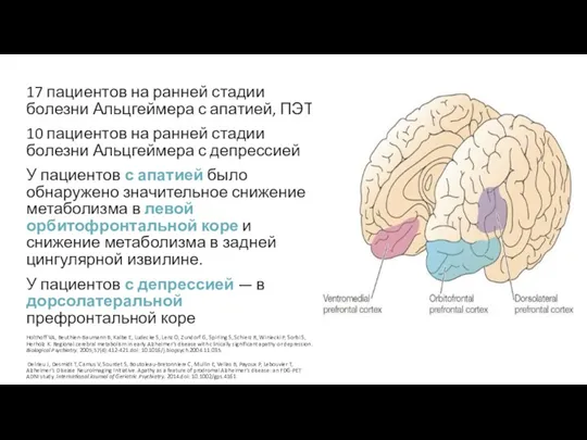 17 пациентов на ранней стадии болезни Альцгеймера с апатией, ПЭТ