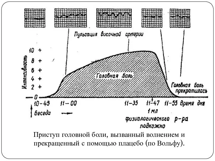 Приступ головной боли, вызванный волнением и прекращенный с помощью плацебо (по Вольфу).