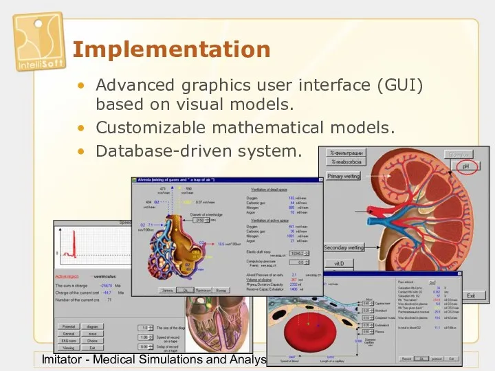 London, 11 May 2002 Imitator - Medical Simulations and Analysis Implementation Advanced graphics