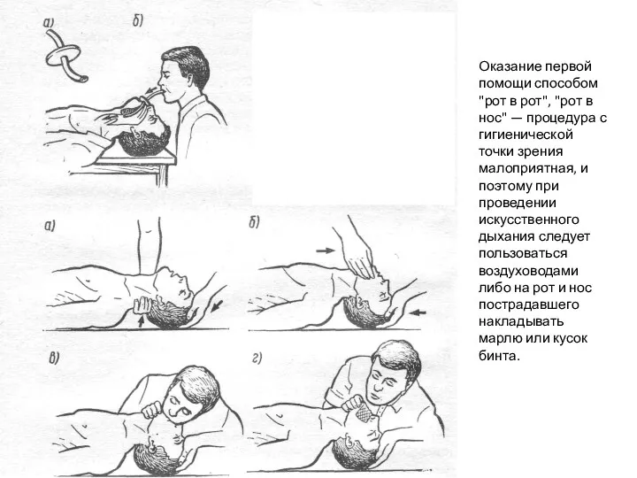 Оказание первой помощи способом "рот в рот", "рот в нос"