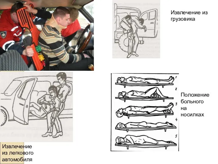 Извлечение из грузовика Извлечение из легкового автомобиля Положение больного на носилках