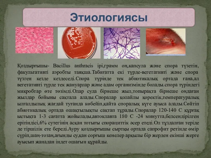 Қоздырғышы- Bacillus anthracis ірі,грамм оң,капсула және спора түзетін,факультативті аэробты таяқша.Табиғатта