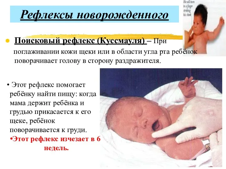 Рефлексы новорожденного Поисковый рефлекс (Куссмауля) – При поглаживании кожи щеки