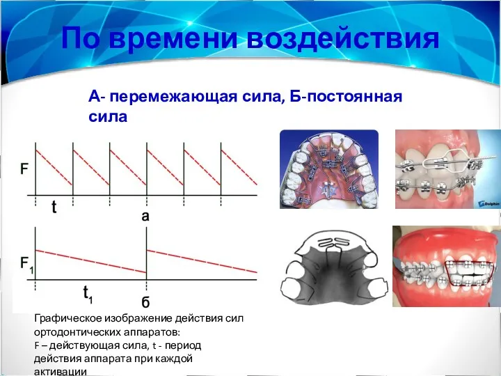 По времени воздействия Графическое изображение действия сил ортодонтических аппаратов: F