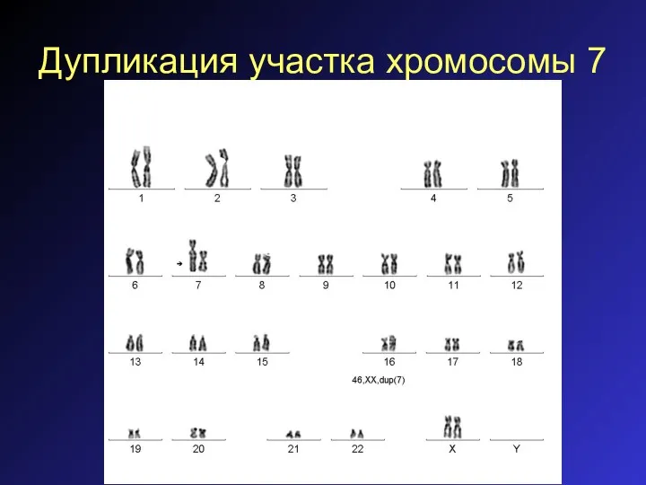 Дупликация участка хромосомы 7