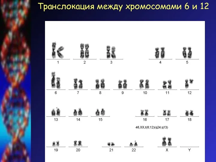 Транслокация между хромосомами 6 и 12