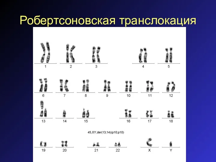 Робертсоновская транслокация