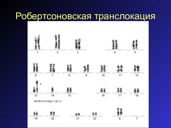 Робертсоновская транслокация