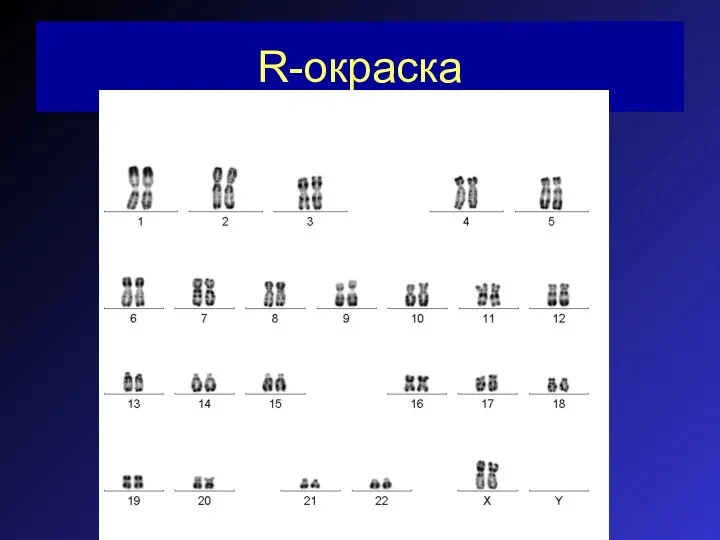 R-окраска