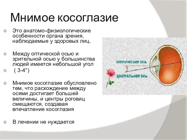 Мнимое косоглазие Это анатомо-физиологические особенности органа зрения, наблюдаемые у здоровых