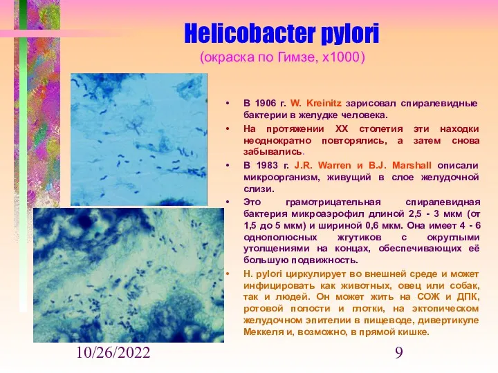 10/26/2022 Helicobacter pylori (окраска по Гимзе, х1000) В 1906 г. W. Kreinitz зарисовал