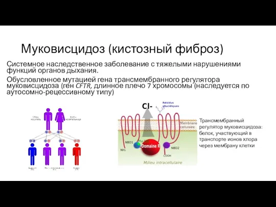 Муковисцидоз (кистозный фиброз) Системное наследственное заболевание с тяжелыми нарушениями функций