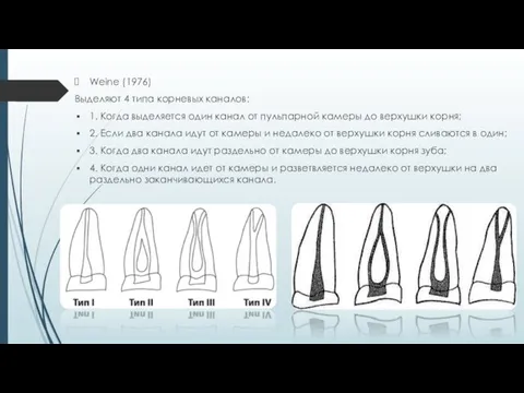 Weine (1976) Выделяют 4 типа корневых каналов: 1. Когда выделяется