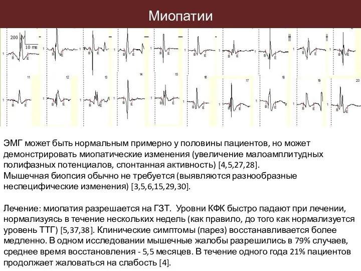 ЭМГ может быть нормальным примерно у половины пациентов, но может